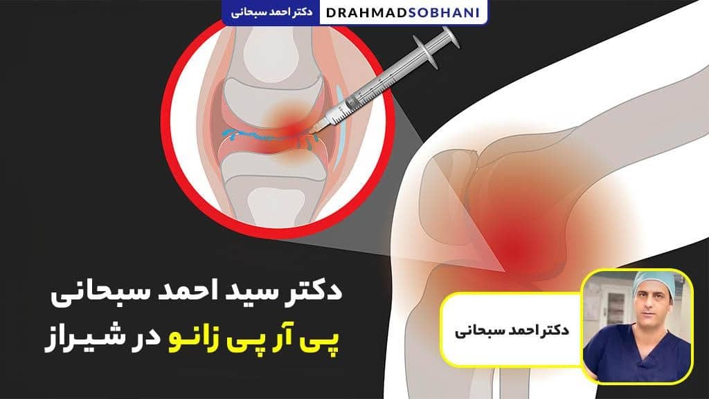 پی آر پی زانو در شیراز (PRP زانو)