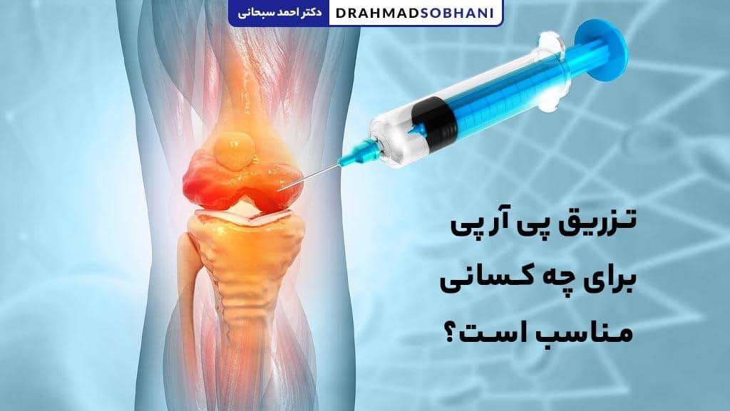 تزریق PRP برای چه کسانی مناسب است؟