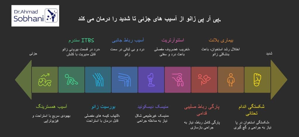 پی آر پی زانو توسط دکتر احمد سبحانی