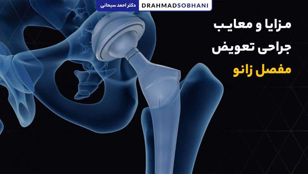 مزایا و معایب جراحی تعویض مفصل زانو