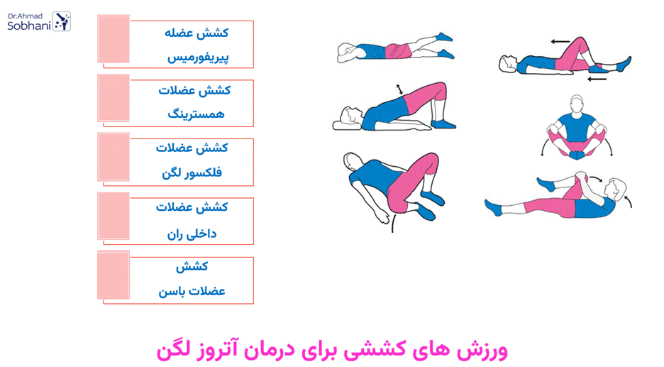 برخی از ورزش های کششی برای درمان آتروز لگن