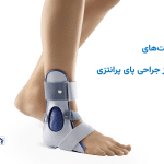 مراقبت‌های بعد از جراحی پای پرانتزی