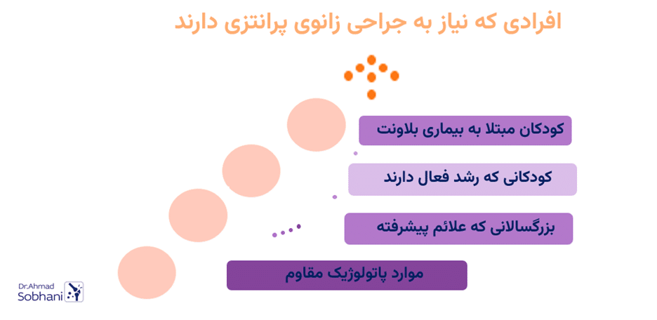 چه افرادی نیاز به جراحی زانوی پرانتزی دارند؟