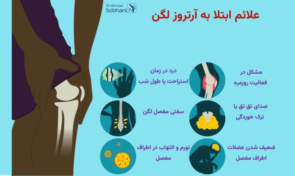 بررسی علائم آرتروز لگن