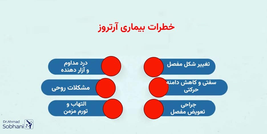بررسی خطرات آرتروز