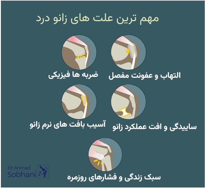 برخی از علت‌ های زانو درد