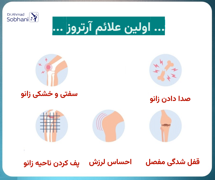 بررسی اولین علائم آرتروز