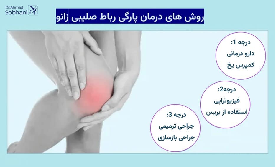 روش های درمان پارگی رباط صلیبی زانو