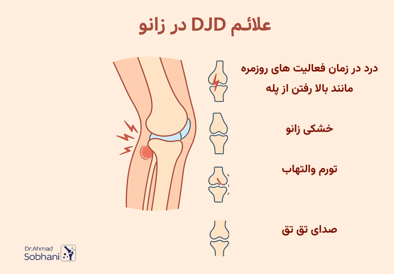 بررسی علائم DJD در زانو