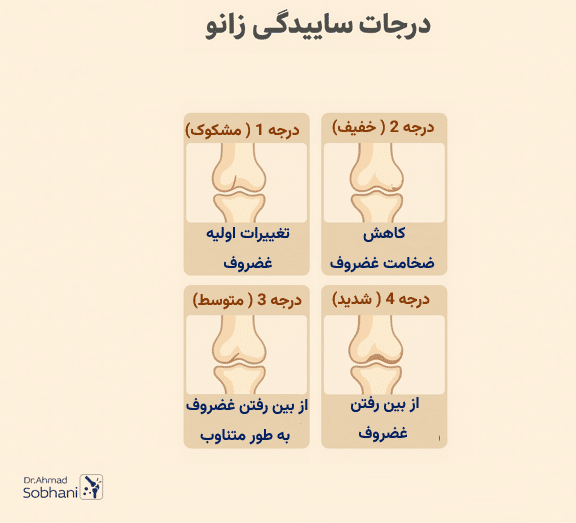 بررسی درجات ساییدگی زانو