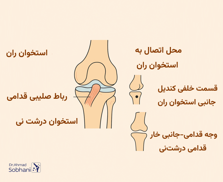 رباط صلیبی چیست؟