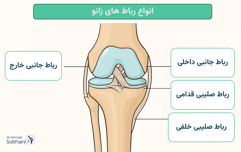 شناخت انواع رباط زانو