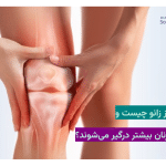 آرتروز زانو چیست و چرا زنان بیشتر درگیر می‌شوند؟