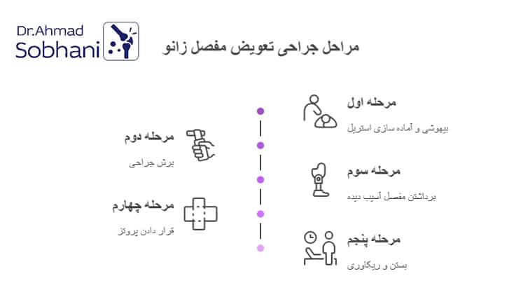 جراحی تعویض مفصل توسط جراحان مفصل زانو